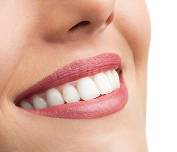 Cosmetic Teeth Whitening Wrentham MA