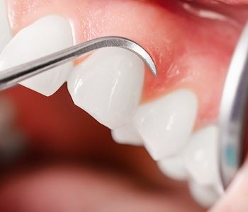 gum disease treatment from dentist in Wrentham