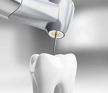 Wrentham can provide root canal therapy without the need for a specialist