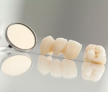 dental crowns