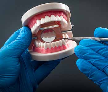 Dental restorations are porcelain pieces made to repair the smile when damage has occurred. 