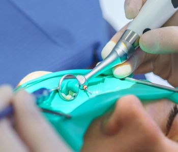 Dental Cavitation Symptoms in Wrentham MA