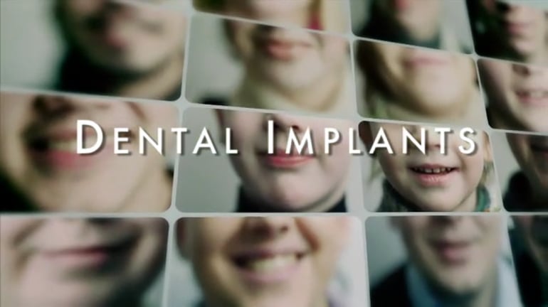 Dental Educational Video on Dental Implants