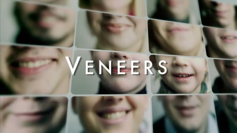 Dental Educational Video on Veneers